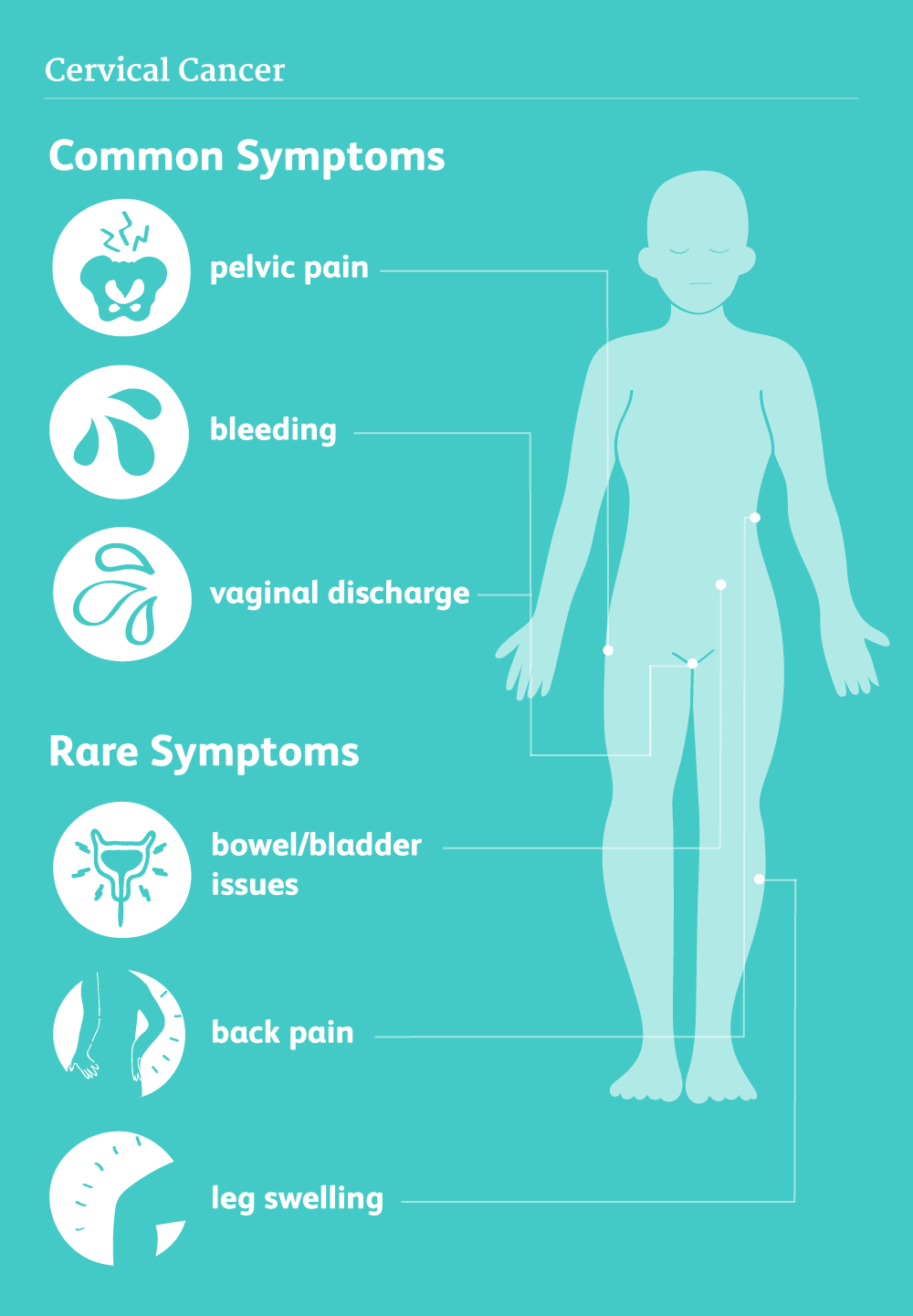 This illustration shows common symptoms of cervical cancer
